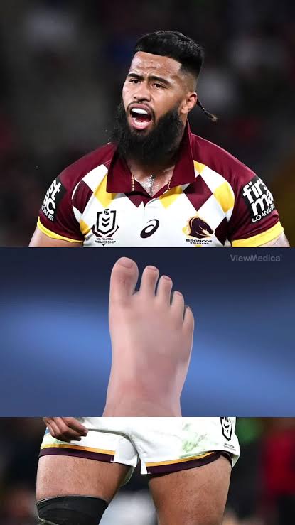 Breaking News: Payne Haas and two key players are Set to lose Saturday’s game against the Cowboys due to…see more 